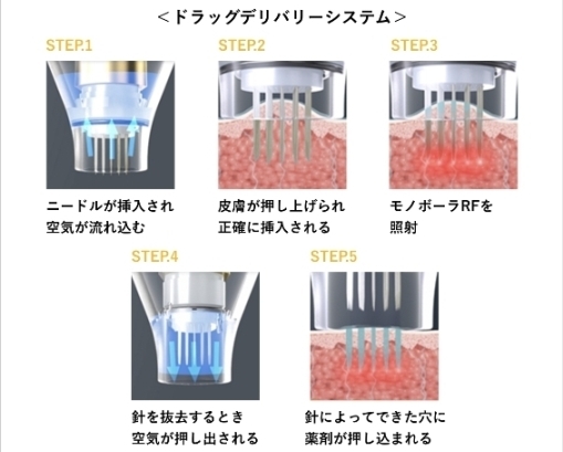 ポテンツァのドラッグデリバリーシステム