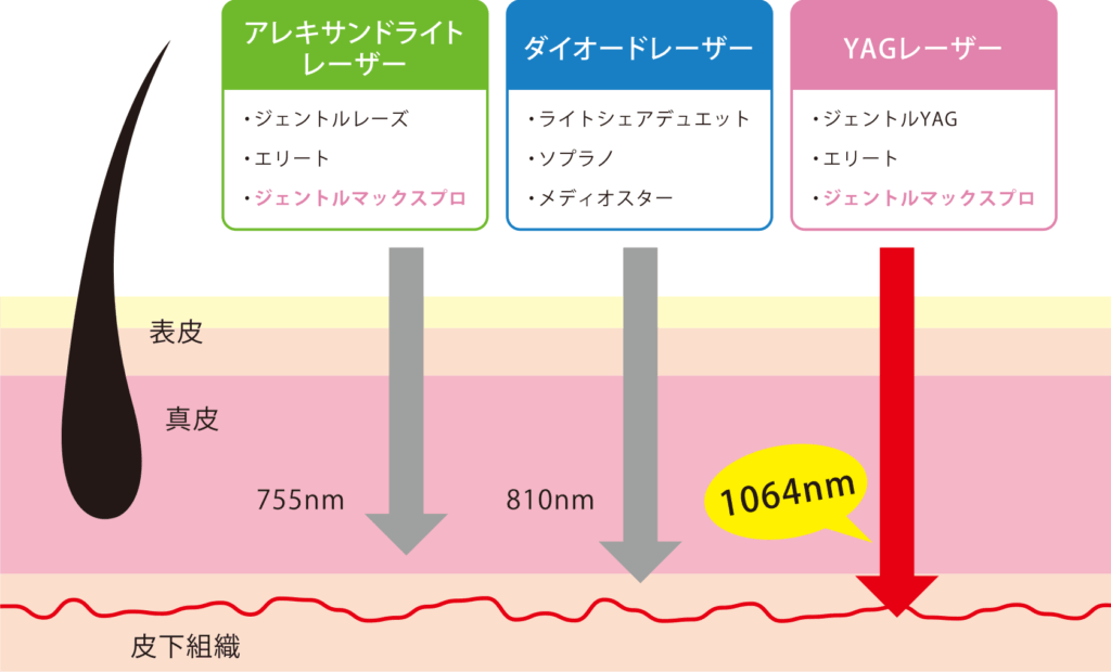大宮ジェントルマックスプロ