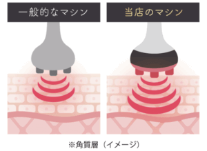 チョコザップのエステマシン